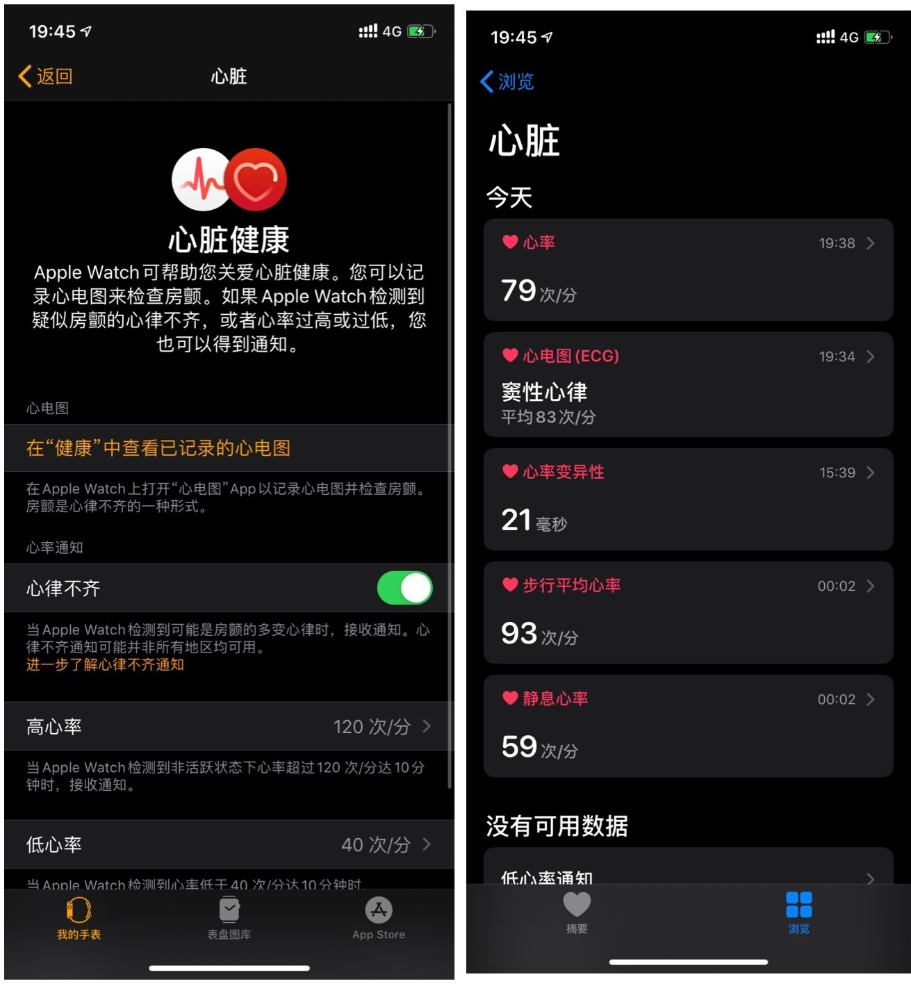 国行 Apple Watch 如何开通 ECG 功能？